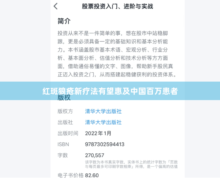 红斑狼疮新疗法有望惠及中国百万患者